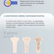 Csontritkulás infografika